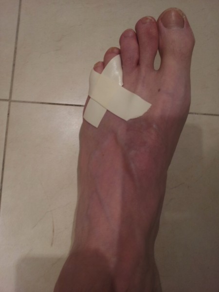 how-to-splint-tape-and-heal-a-broken-pinkie-toe